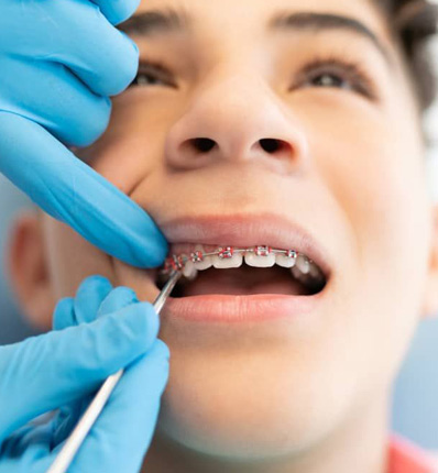 Children's Braces