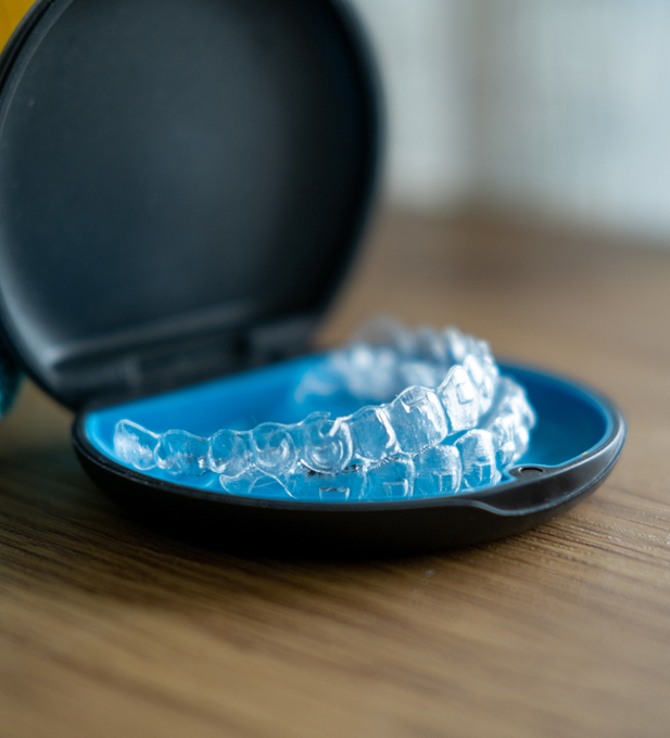 What are retainers?