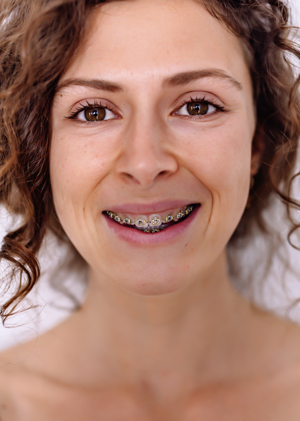 Advice for All Brace Types