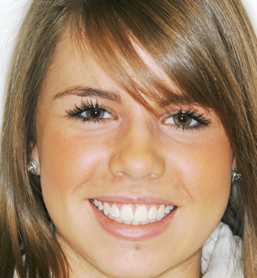 Smile Gallery