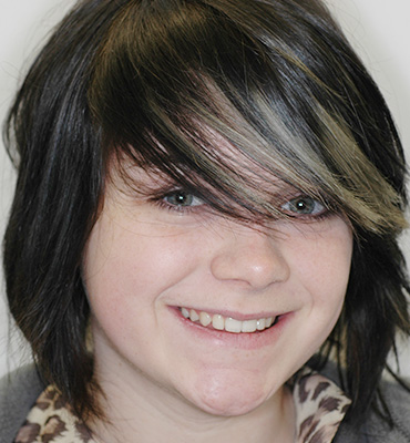Smile Gallery
