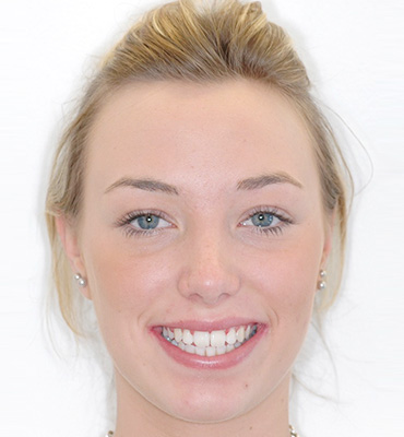 Smile Gallery