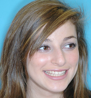 Smile Gallery