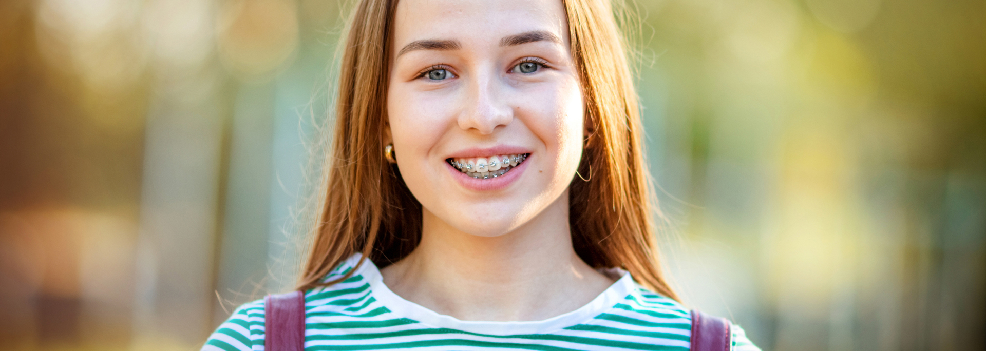metal braces